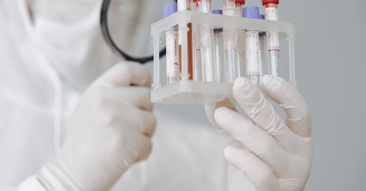 借钱平台需要开户金